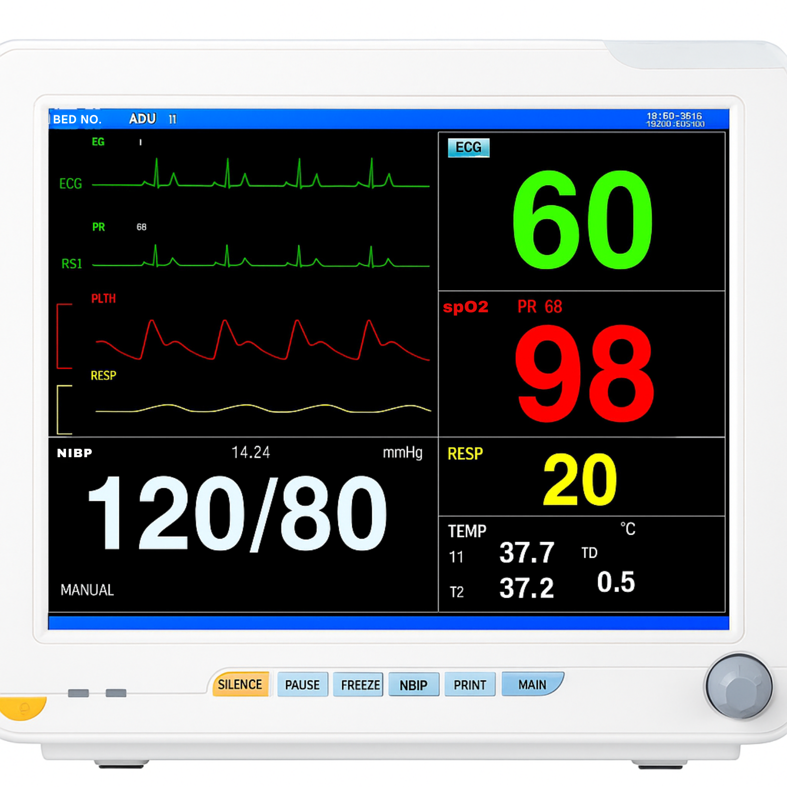 Bedside Monitors