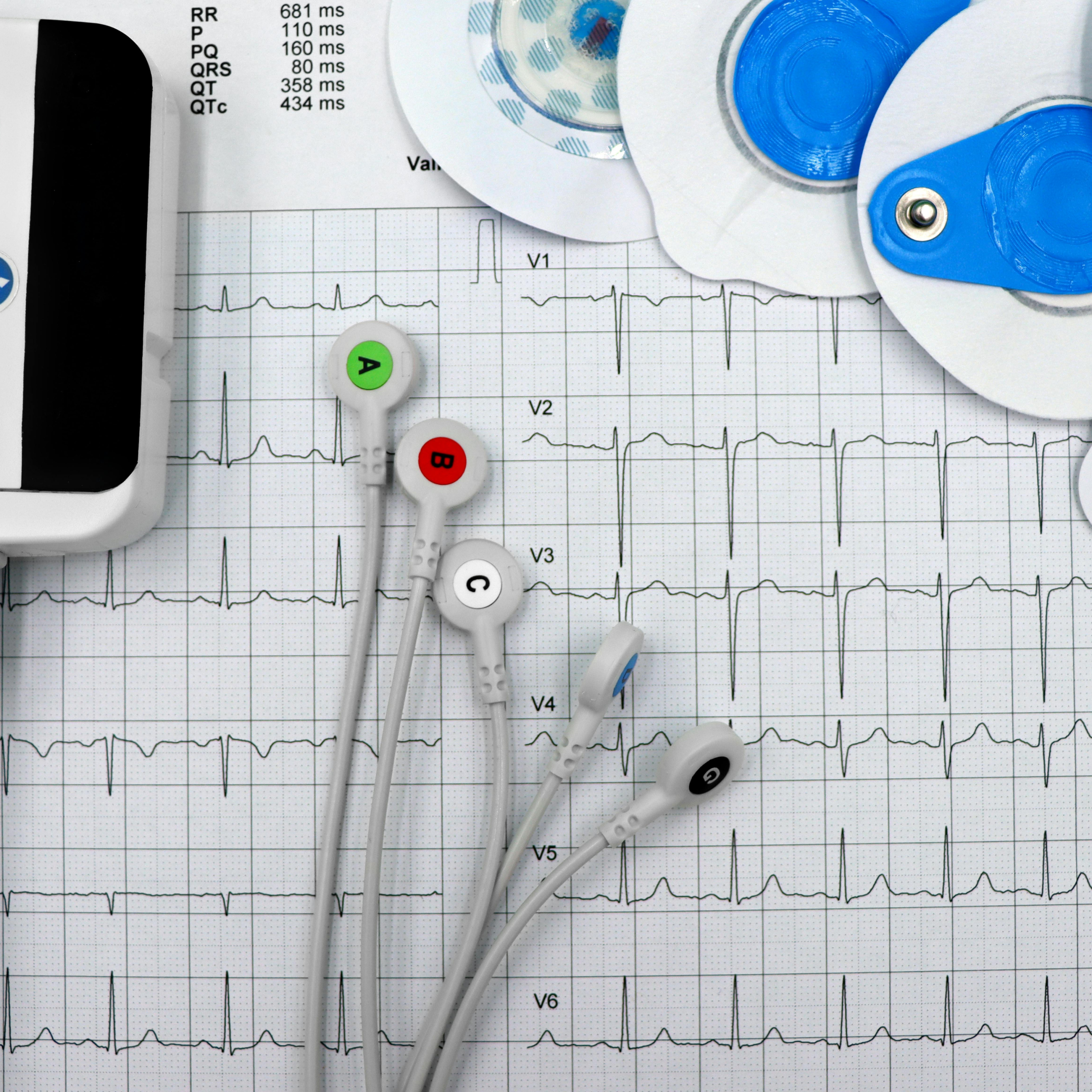 ECG Monitors